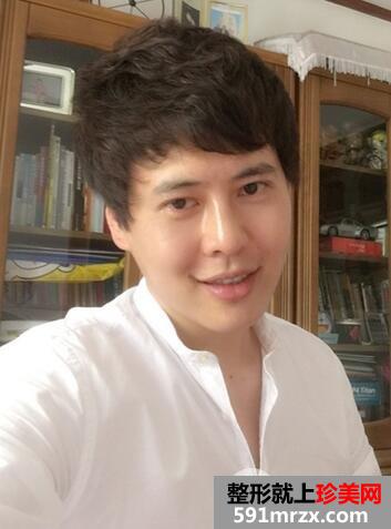 激光去雀斑8
