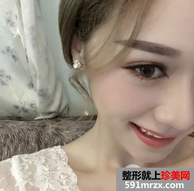 全切双眼皮9