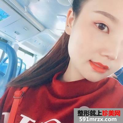 成都艾米丽医疗美容鼻综合要多少钱|硅胶隆鼻+耳软骨垫鼻尖+鼻中隔