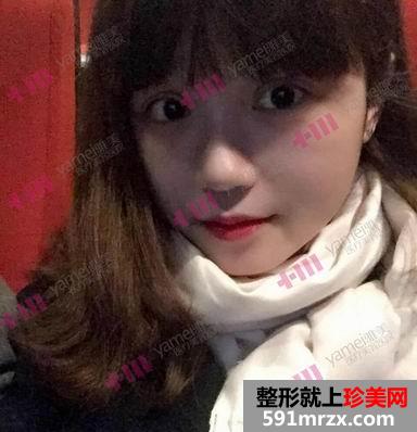 长沙,雅美,翘睫,美瞳术,让我,神采奕奕