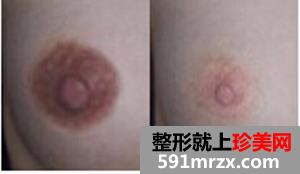 乳晕漂红 粉粉嫩嫩更诱人