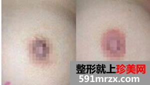 乳晕漂红 粉粉嫩嫩更诱人