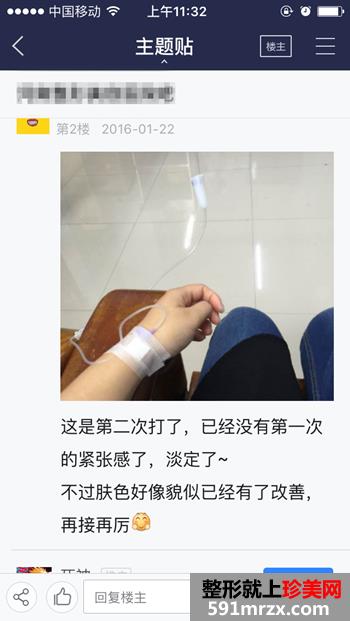 注射美白针五次了 美白的效果越来越明显