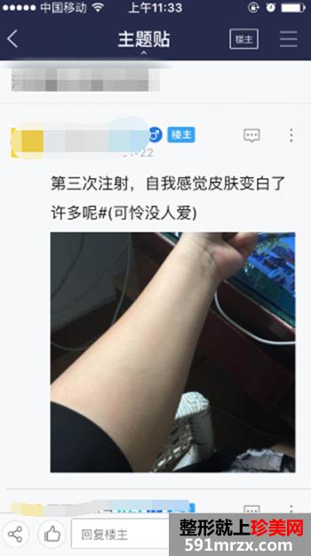 注射美白针五次了 美白的效果越来越明显