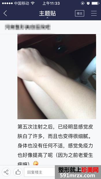 注射美白针五次了 美白的效果越来越明显