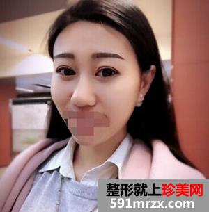当丑女变成美女 你能体会我是怎样一种心情吗