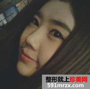 卧蚕眼,卧蚕美女