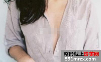 新维度自体脂肪隆胸,北京自体脂肪隆胸术