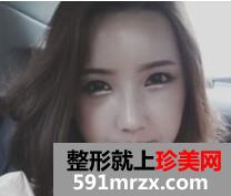 埋线双眼皮+激光治疗黑眼圈 像不像混血美女
