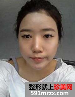 卧蚕眼,卧蚕美女