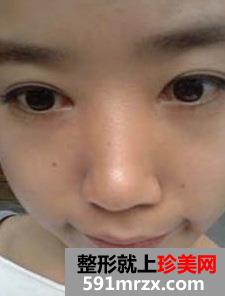 卧蚕眼,卧蚕美女