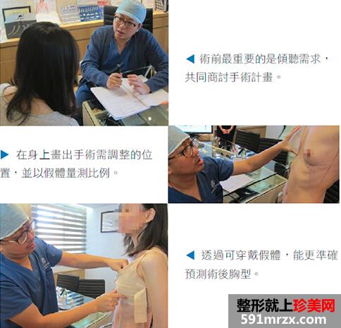 进口假体隆胸,沙滩比基尼美女