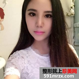 终于做了鼻综合整形，效果图分享