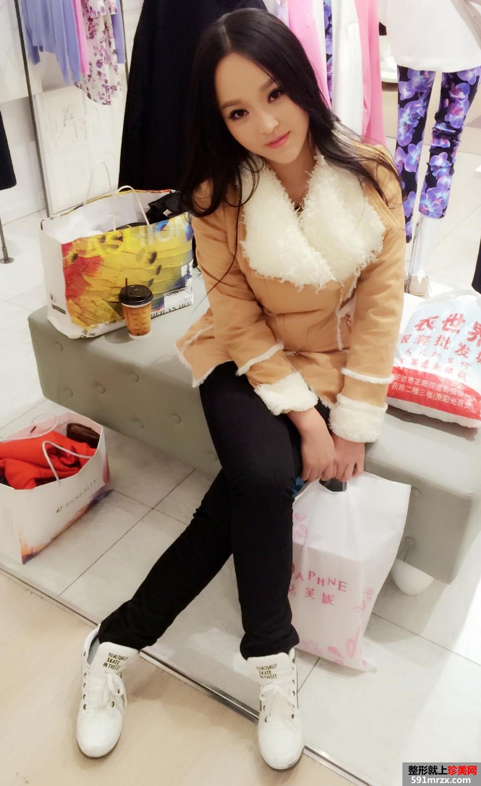 3度仿生美鼻+彩光祛雀斑+多维立体丰下颏前后对比效果图片