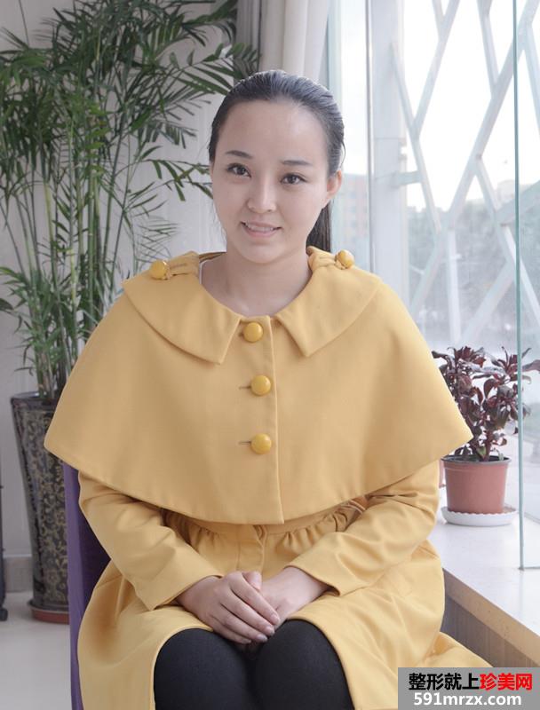 3度仿生美鼻+彩光祛雀斑+多维立体丰下颏前后对比效果图片