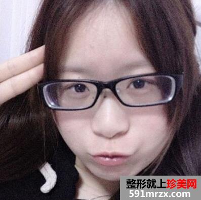 激光美容祛斑好不好