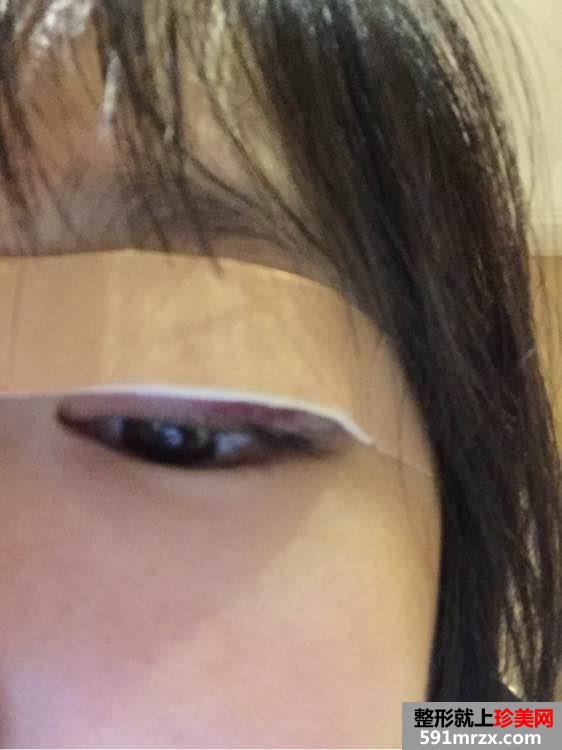 上海,喻德军,三点式,双眼皮,技术很好