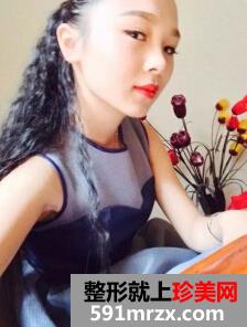 膨体隆鼻需要几天恢复