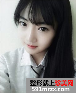 下颌角整形后成功拥有瓜子小脸！