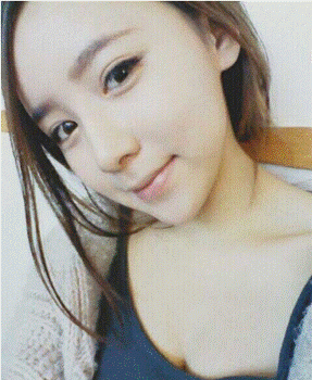 假体隆鼻后效果自然吗 来看看这位美女吧