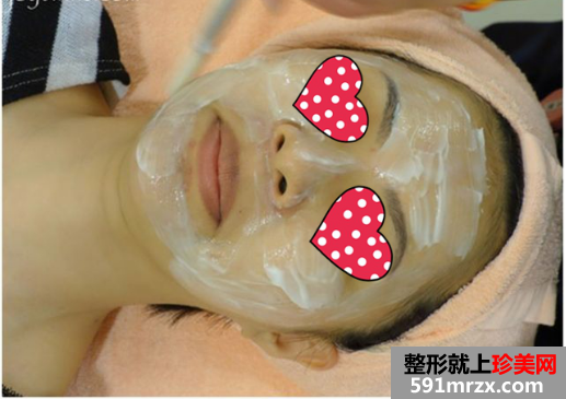 郑州梨花雨整形医院音波拉皮 宝妈不服老