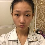 亓官实锦亓官的日记分享 术前图1