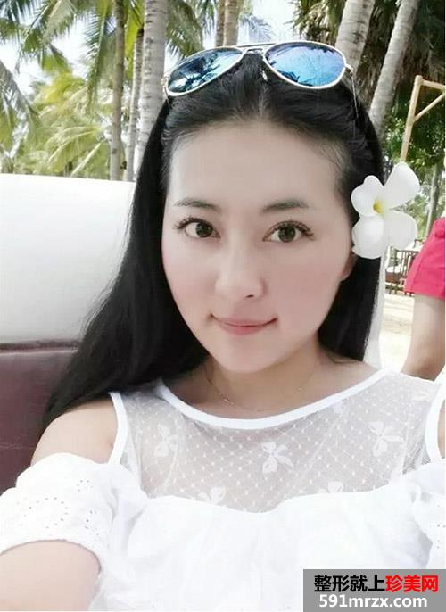 合肥韩美整形医院面部整形精心塑美 我是这样变得人见人爱