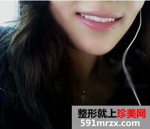 宁波美莱整形医院美容冠 我爱死现在的牙齿了
