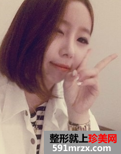 硅胶假体隆鼻+自体脂肪丰额头 驾驭各种发型