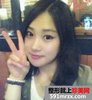 为变美做了磨骨瘦脸、垫鼻尖和眼部整形