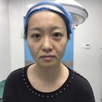 叫我老板娘的日记分享 术前图3