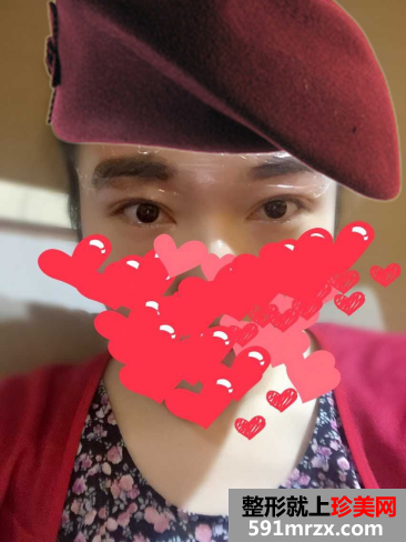 苏州维多利亚整形医院做的韩式半永久纹眉效果