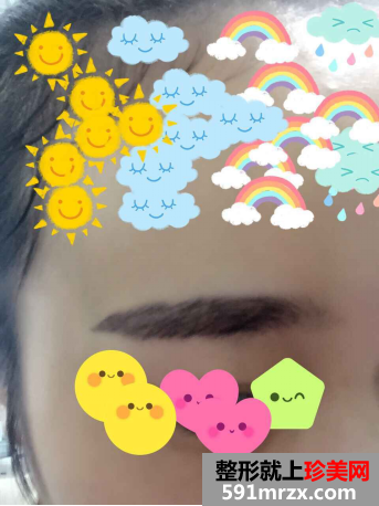 苏州维多利亚整形医院做的韩式半永久纹眉效果