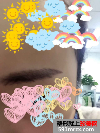 苏州维多利亚整形医院做的韩式半永久纹眉效果