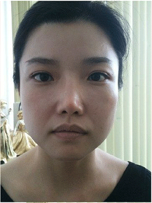 怎么样,才能,减双下巴,可以,看看,我的,蜕变,过程