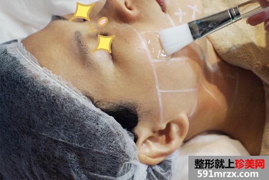 上海,伊莱美,整形,医院,音波,拉皮,双下巴
