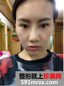 图片44.png