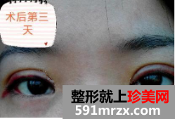 图片31.png