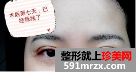 图片32.png