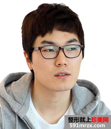 打瘦脸针+硅胶隆鼻前后对比效果图