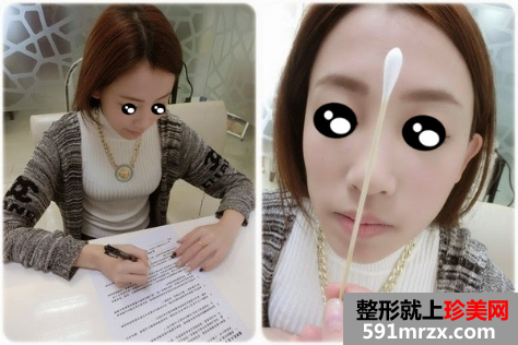 沈阳协和整形美容医院玻尿酸隆鼻后 终于不用狂打鼻影了