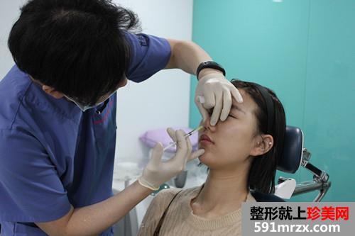 玻尿酸注射隆鼻手术前后效果对比图和恢复过程