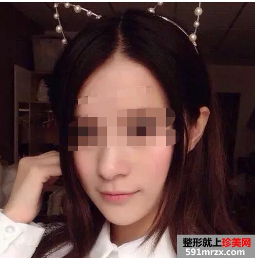 做了白瓷娃娃 皮肤变得好棒