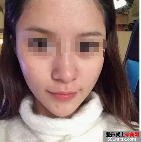 做了白瓷娃娃 皮肤变得好棒