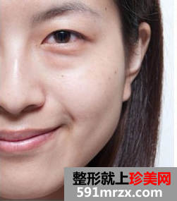 爱贝芙注射美容 让我更加自信美丽