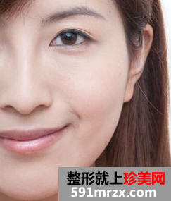 爱贝芙注射美容 让我更加自信美丽