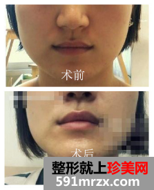 图片8.png