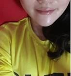 下颌角磨骨术恢复 四方女变成锥子脸的亲身经历分享