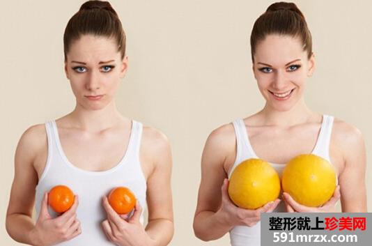 假体隆胸多少钱?!