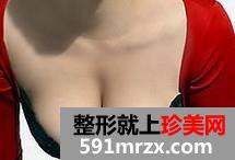 麦格乳房假体隆胸过程 30岁妈妈的真实经历